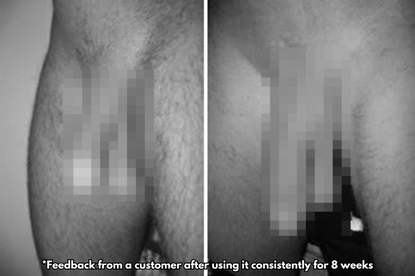 Tiworld VitalEngine Pro – The #1 5-in-1 at-home trainer that reverses ED & PE with advanced precision